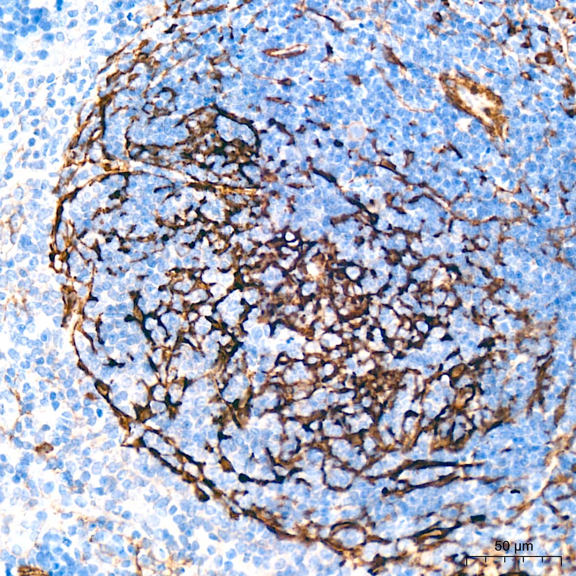 Myosin heavy chain 11 Antibody (0O4O4)