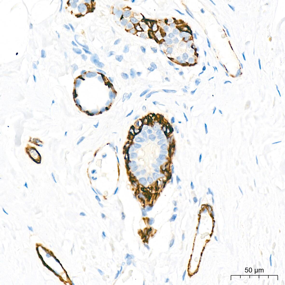 Myosin heavy chain 11 Antibody (0O4O4)