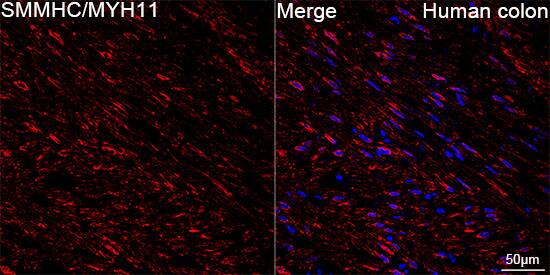 Myosin heavy chain 11 Antibody (0O4O4)