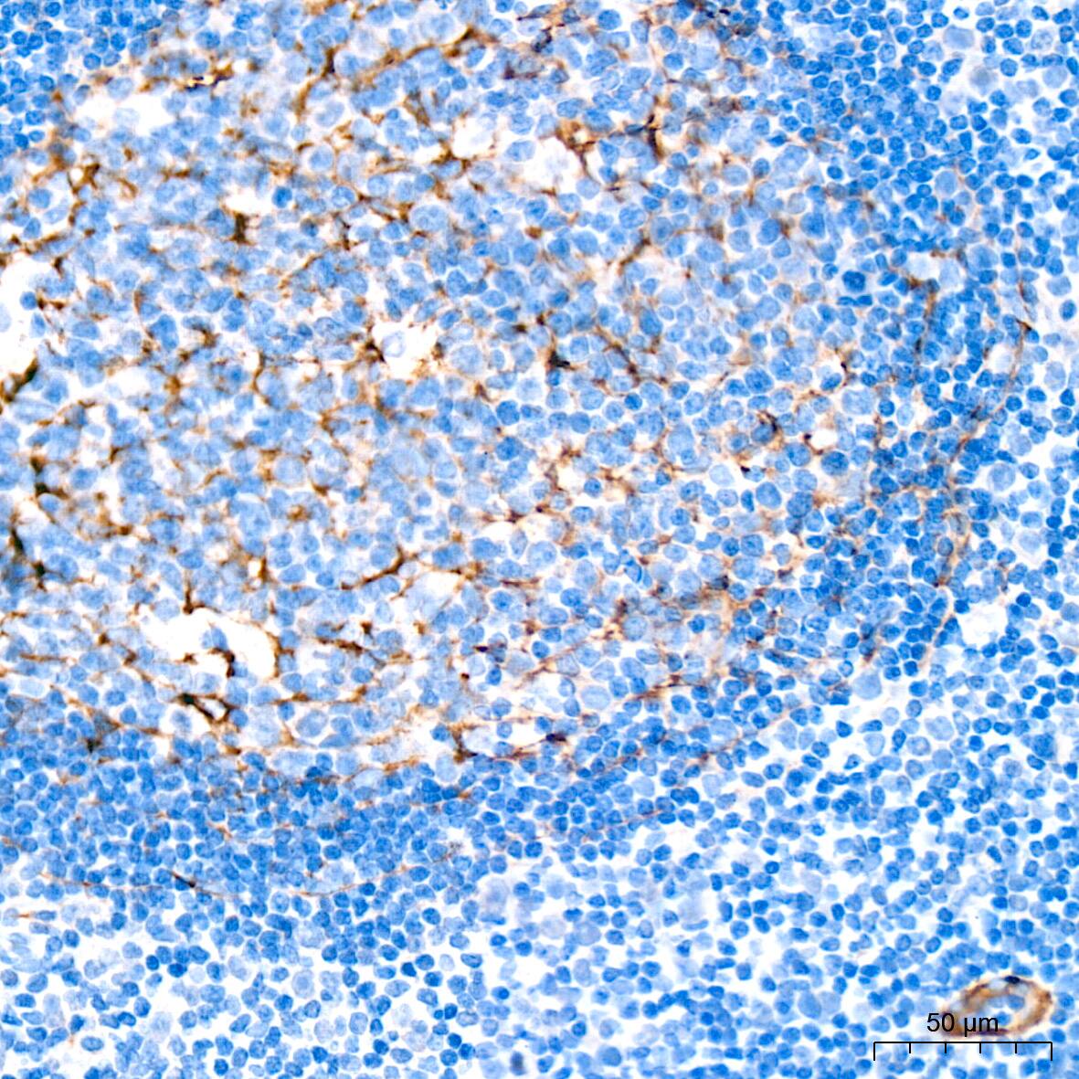 Myosin heavy chain 11 Antibody (0O4O4)