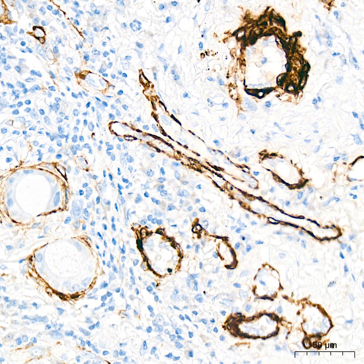 Myosin heavy chain 11 Antibody (0O4O4)