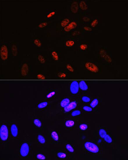 Cyclin H Antibody (3N5S3)