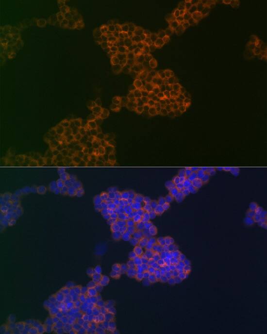 CD3 gamma Antibody (7J2L5)