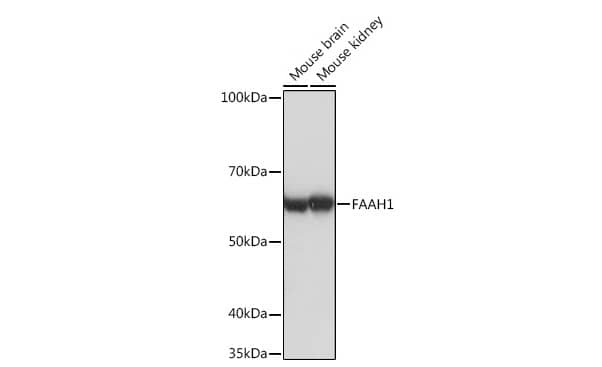 FAAH Antibody (10A1M7)