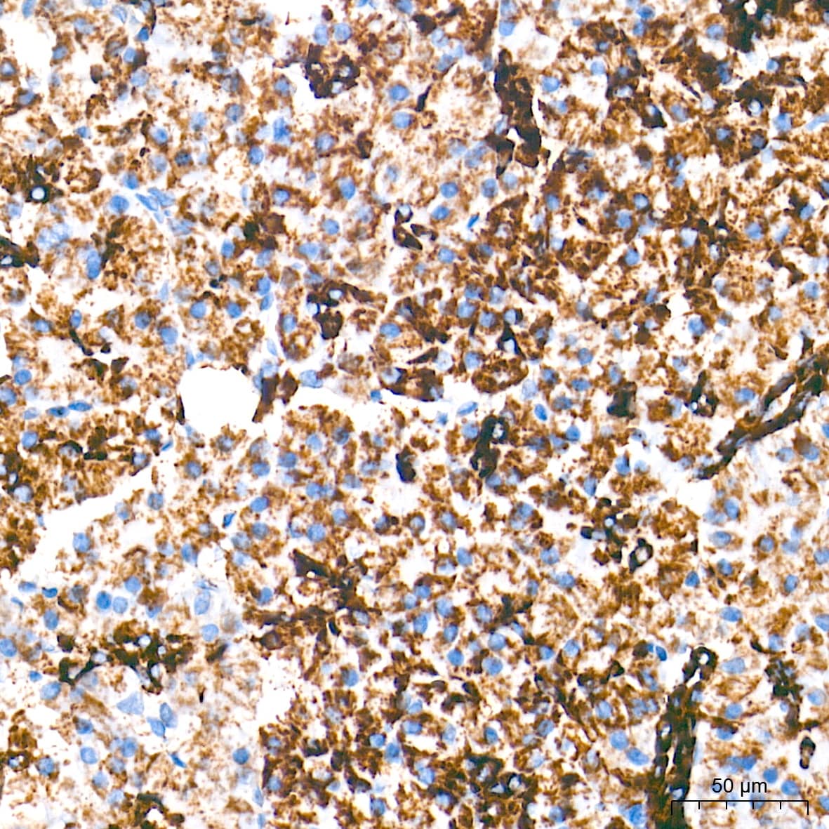 MAO-A Antibody (9U8P8)