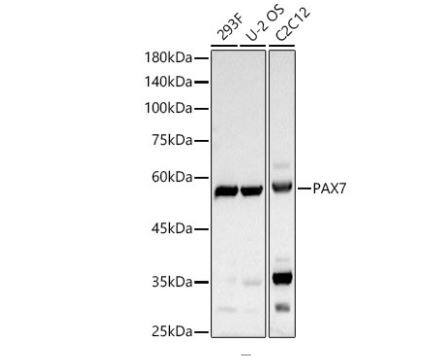 Pax7 Antibody (5G2Q9)