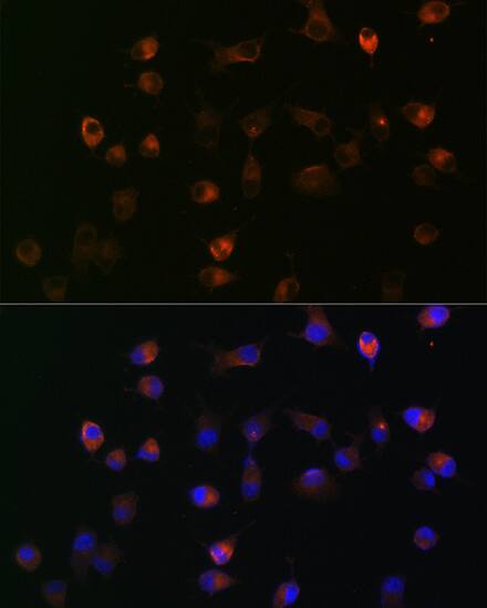 gamma Catenin Antibody (9O2K8)