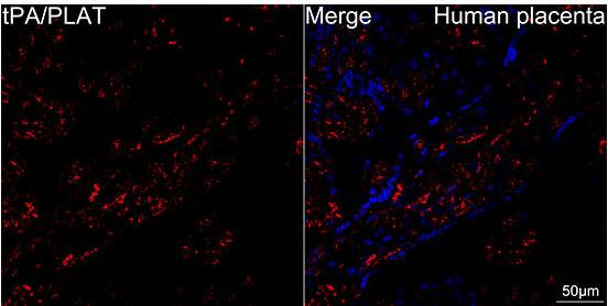t-Plasminogen Activator/tPA Antibody (10W4L1)