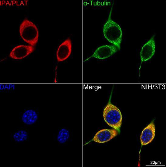 t-Plasminogen Activator/tPA Antibody (10W4L1)