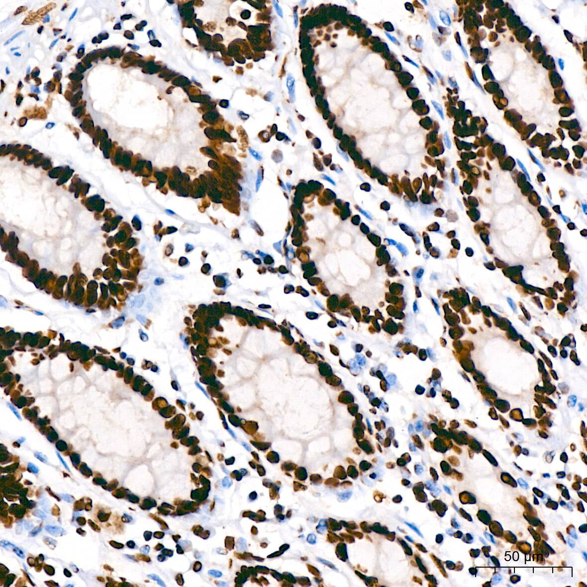 hnRNP U Antibody (3R3F1)