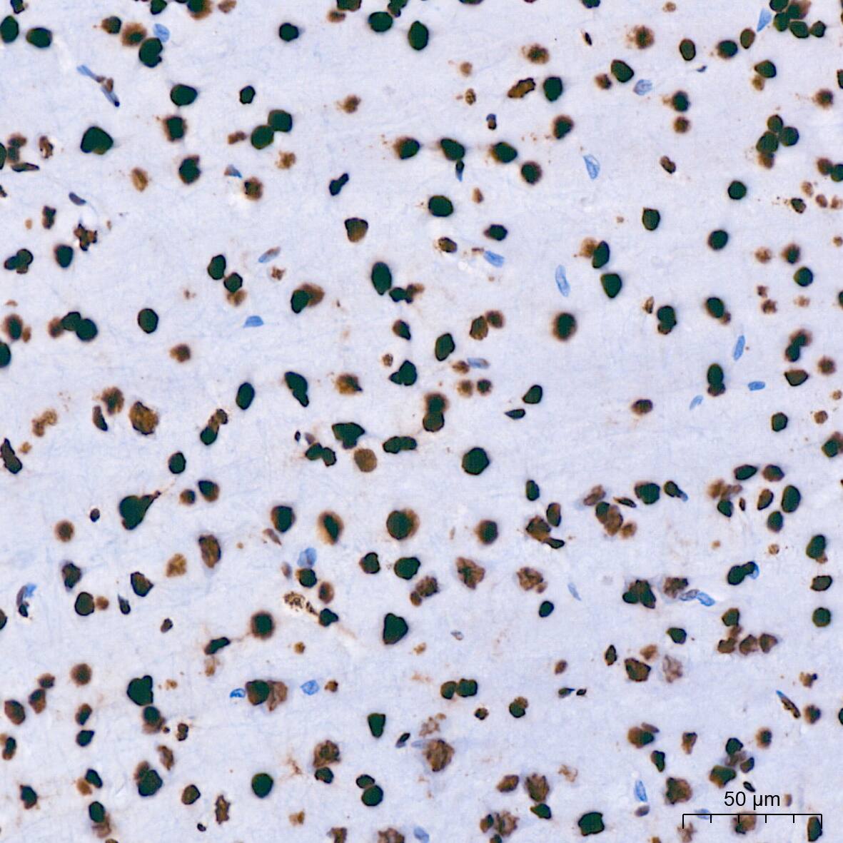 hnRNP U Antibody (3R3F1)