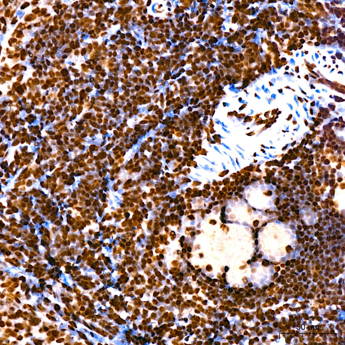 hnRNP U Antibody (3R3F1)