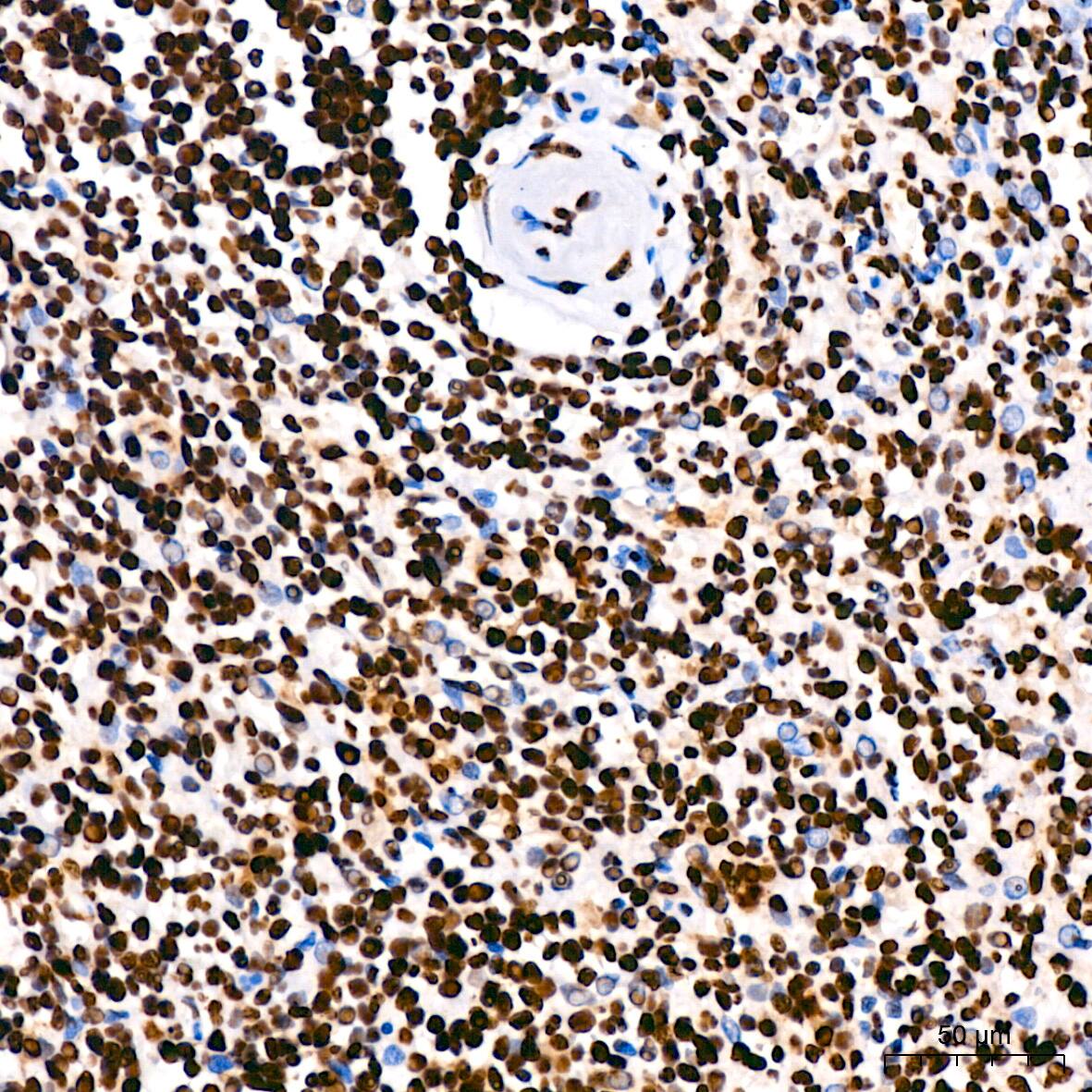 hnRNP U Antibody (3R3F1)