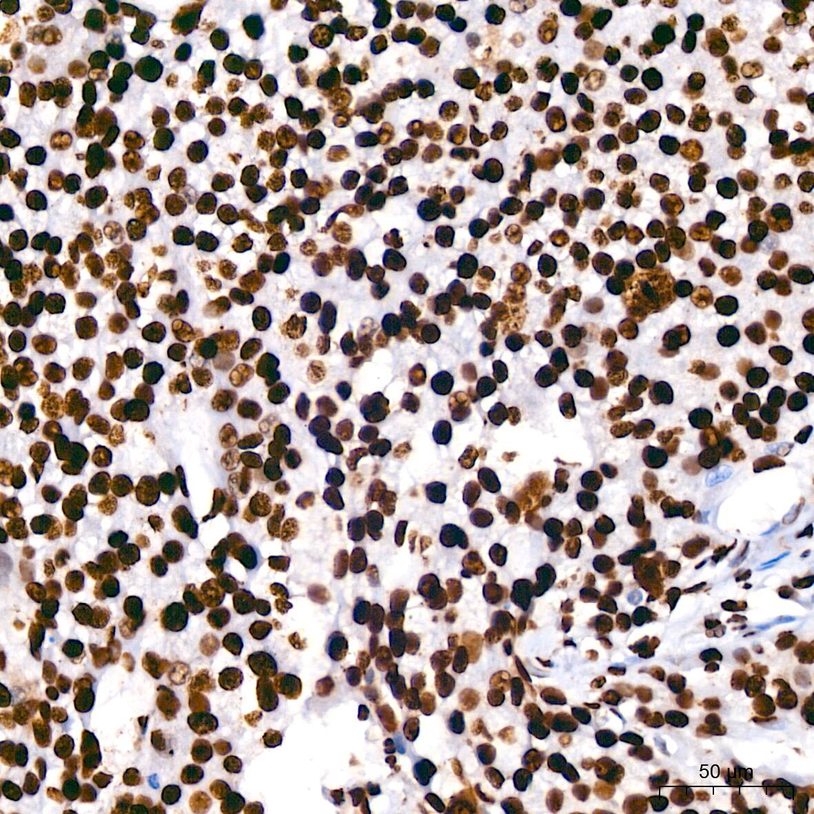 hnRNP U Antibody (3R3F1)