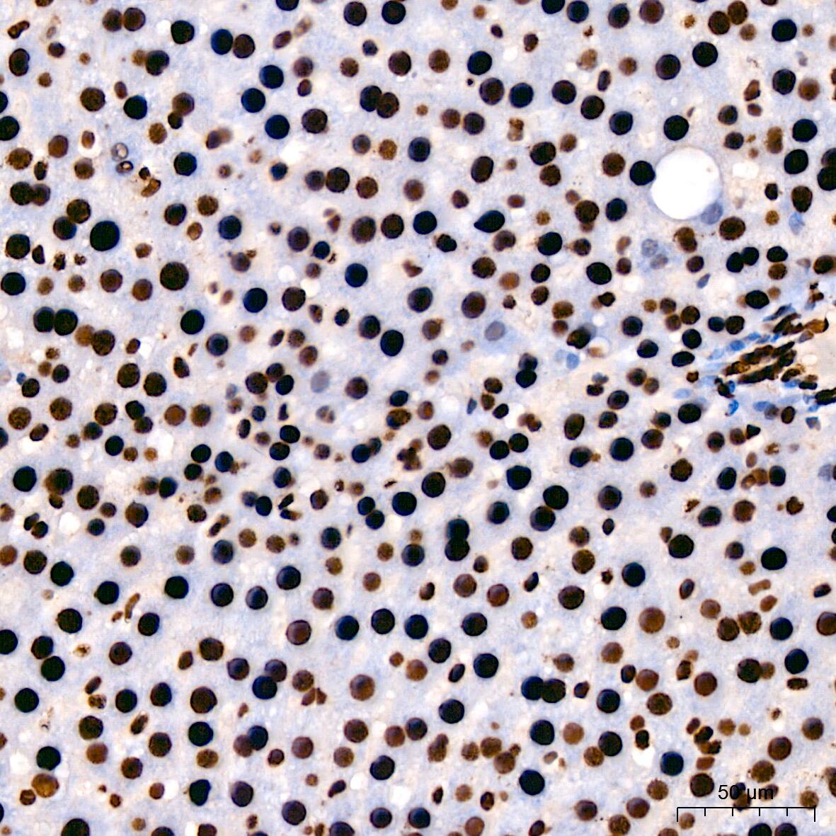 hnRNP U Antibody (3R3F1)