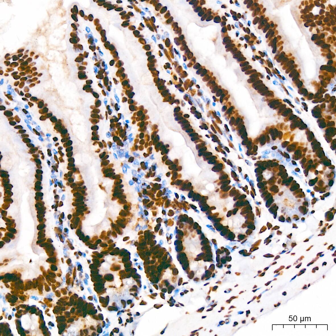 hnRNP U Antibody (3R3F1)