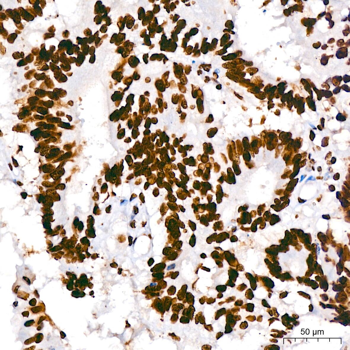 hnRNP U Antibody (3R3F1)