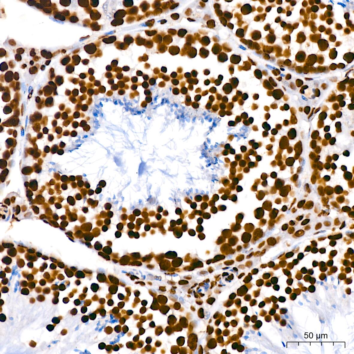 hnRNP U Antibody (3R3F1)