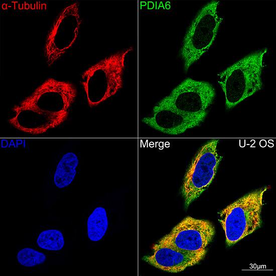 PDIA6 Antibody (2Q1L1)
