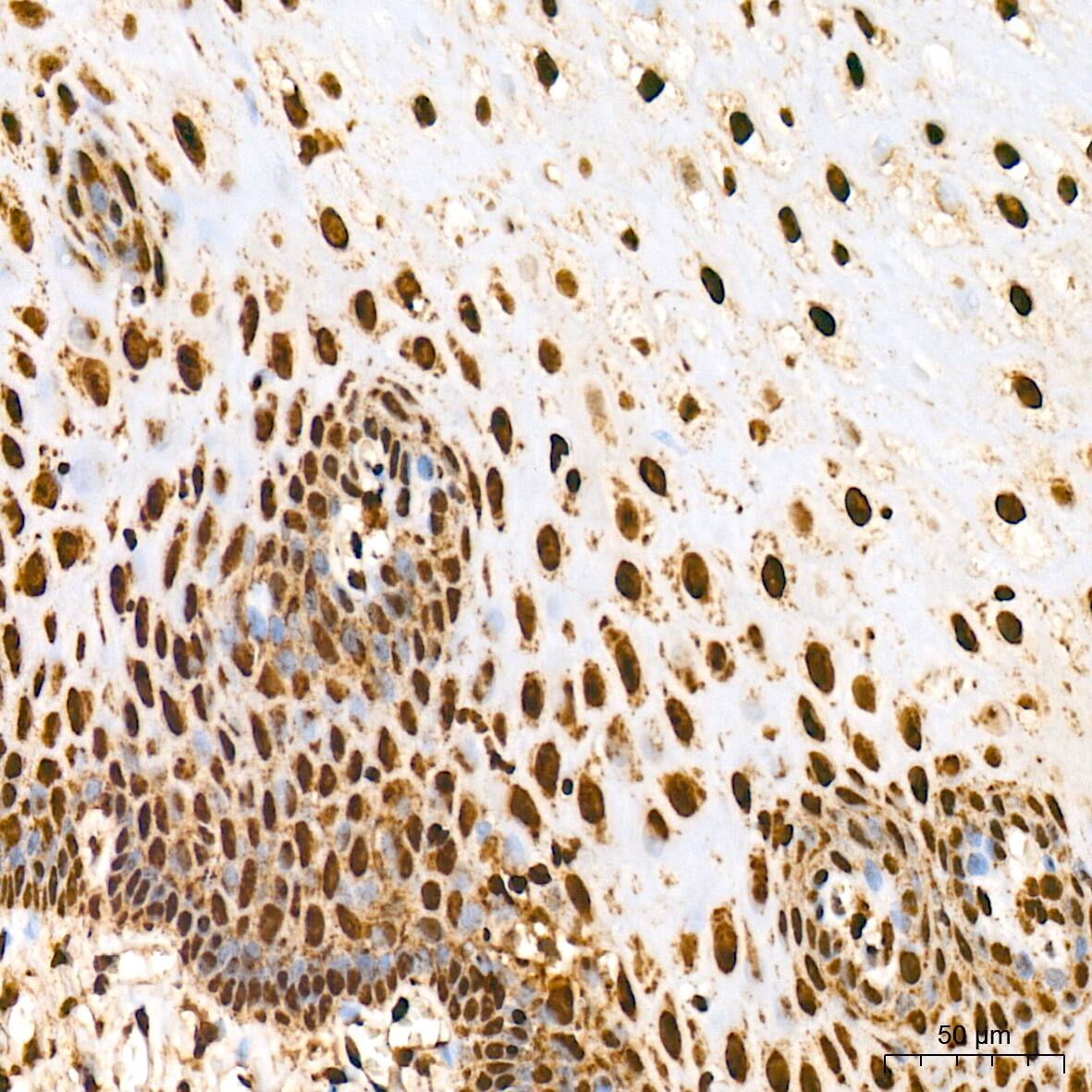 Aly Antibody (6I4T10)