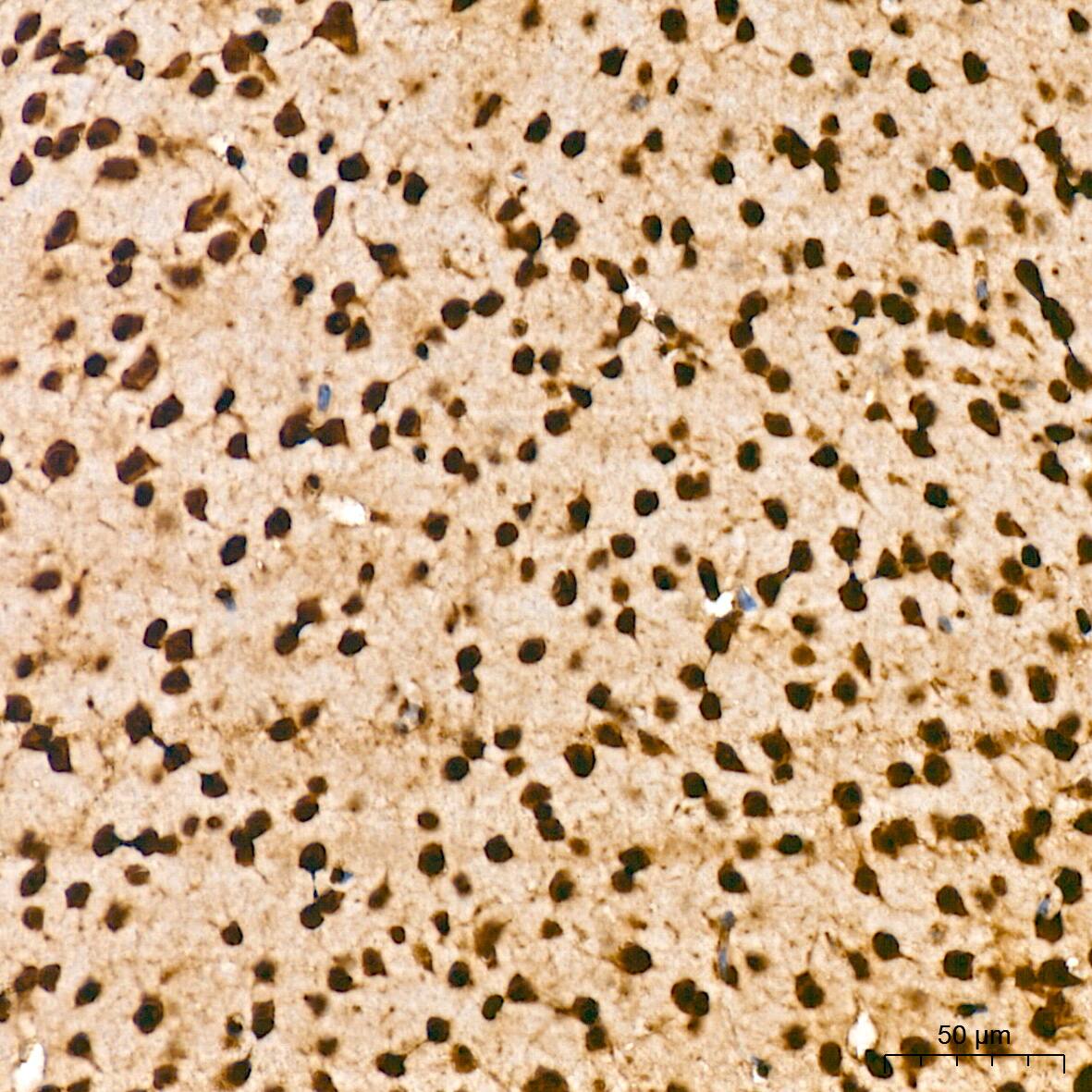 Aly Antibody (6I4T10)