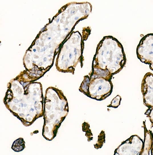 Alkaline Phosphatase/ALPP/ALPI Antibody (10Q2X7) Alkaline Phosphatase/ALPP/ALPI Antibody (10Q2X7)