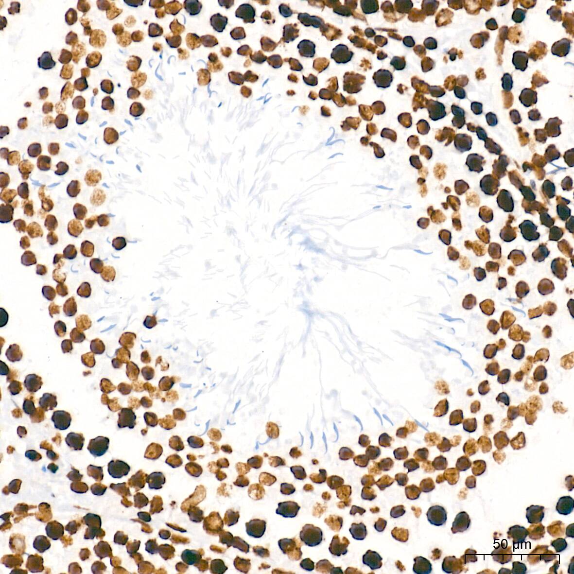 HMGA1 Antibody (5J0E6)