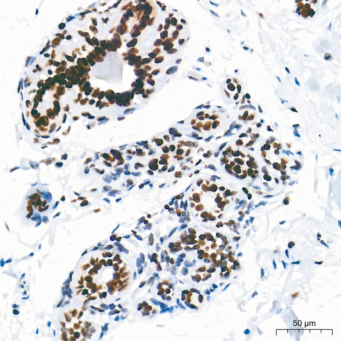 HMGA1 Antibody (5J0E6)