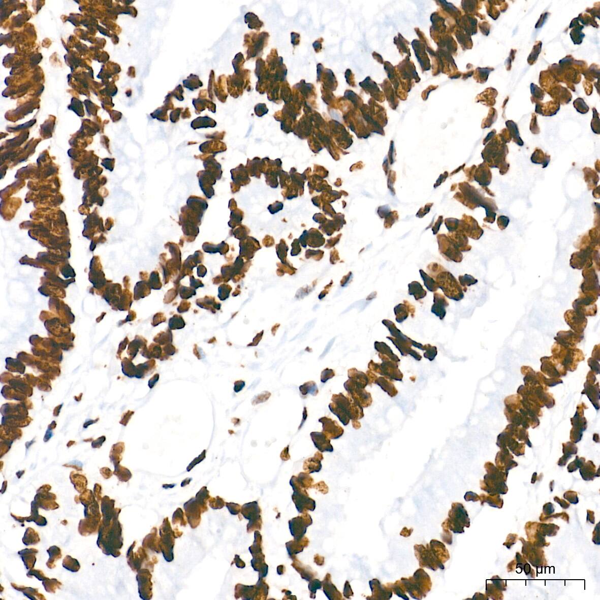 HMGA1 Antibody (5J0E6)