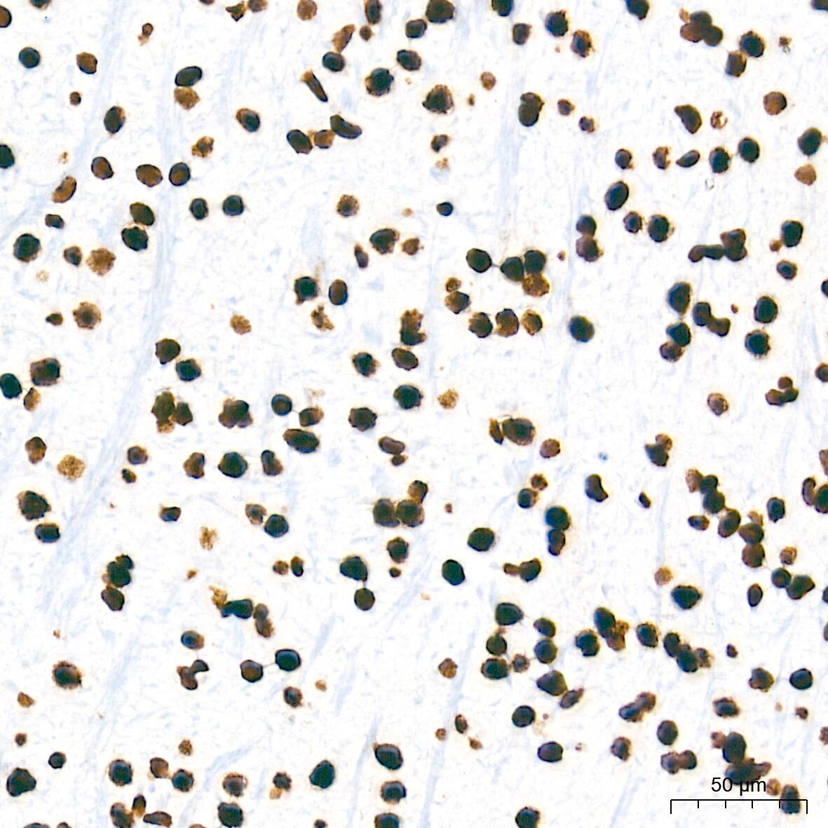 HMGA1 Antibody (5J0E6)