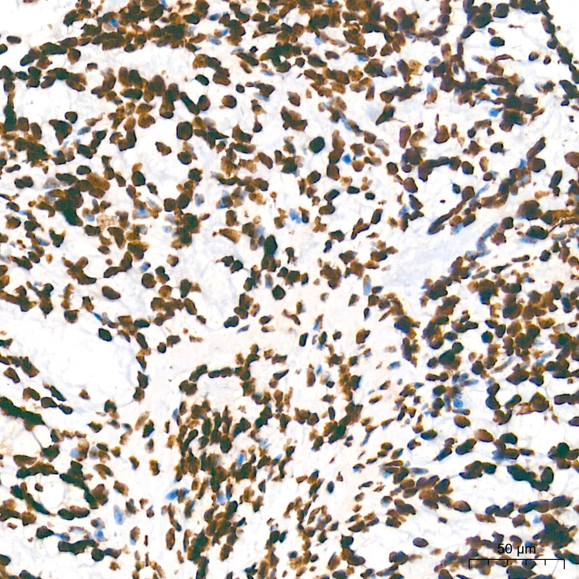 HMGA1 Antibody (5J0E6)