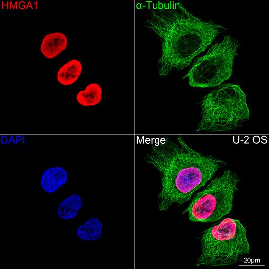 HMGA1 Antibody (5J0E6)