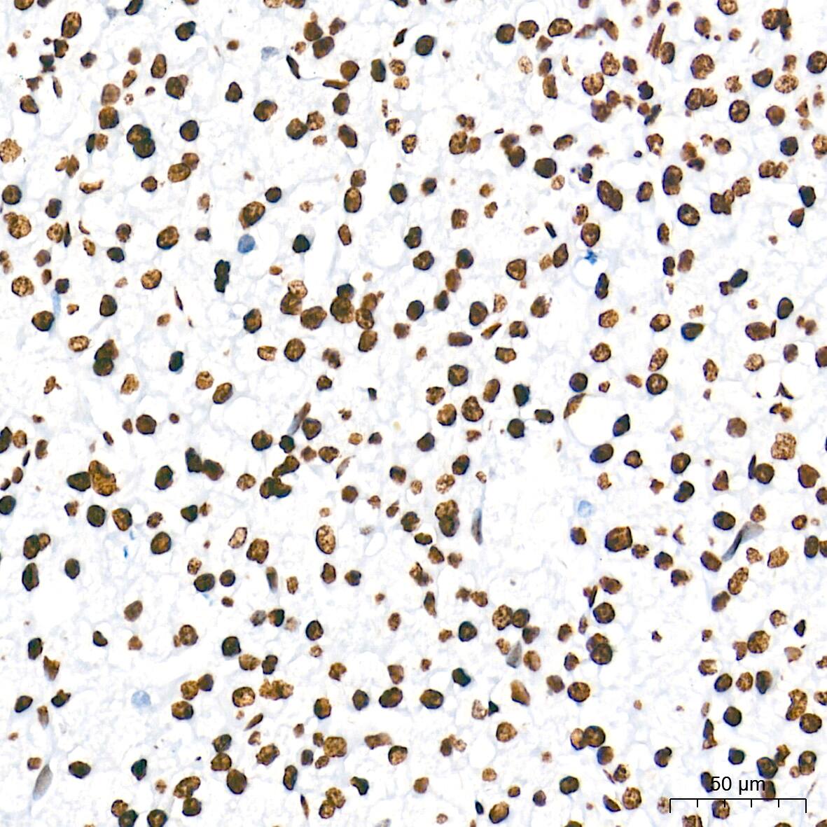 HMGA1 Antibody (5J0E6)