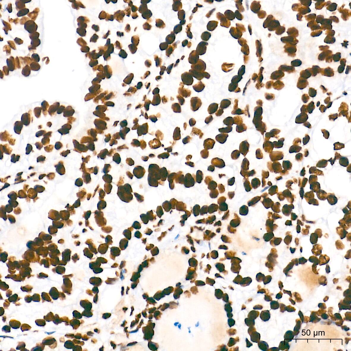 HMGA1 Antibody (5J0E6)
