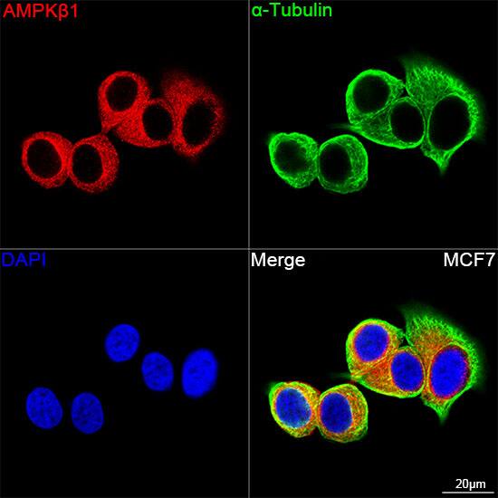 AMPK beta 1 Antibody (7G8U1)