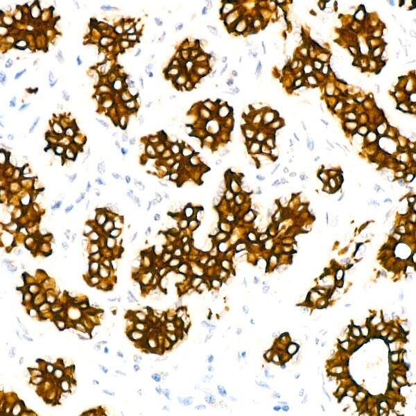 Cytokeratin 7 Antibody (5V4M10)