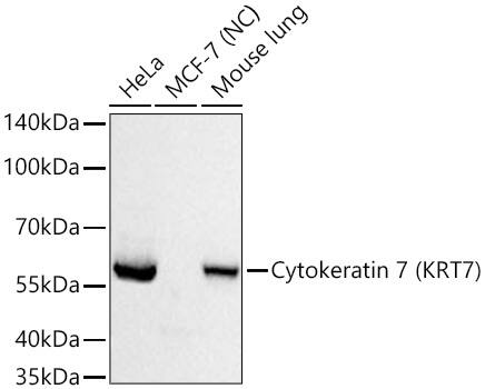 Cytokeratin 7 Antibody (5V4M10)