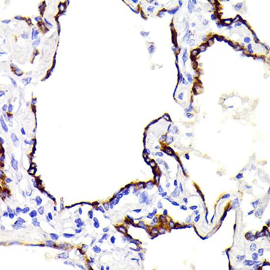 Cytokeratin 7 Antibody (5V4M10)