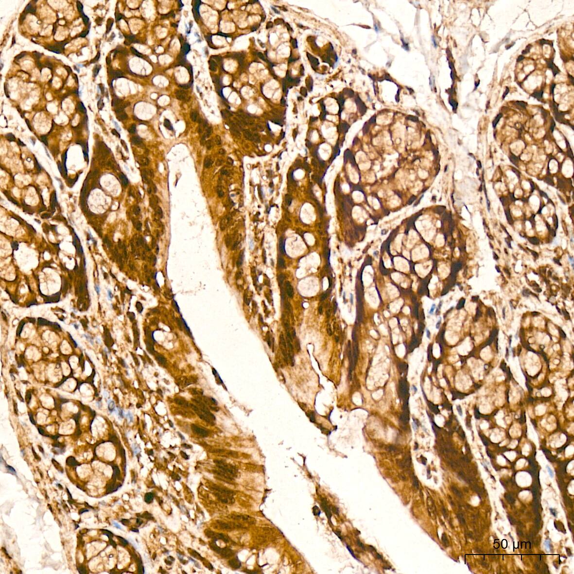 Protein Phosphatase 1 beta Antibody (5O9E7)
