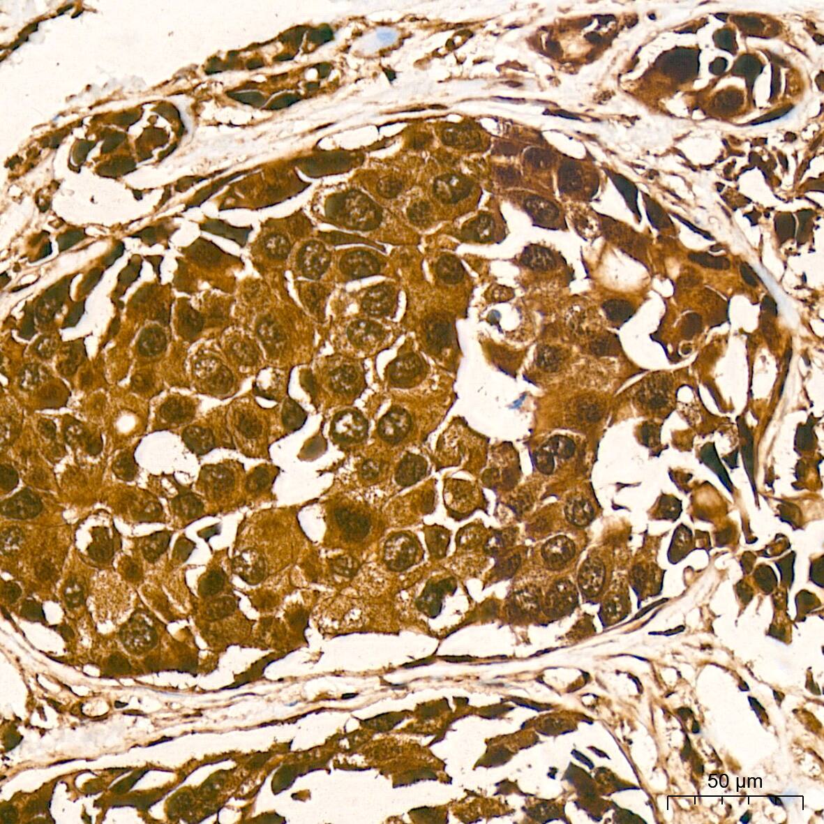 Protein Phosphatase 1 beta Antibody (5O9E7)