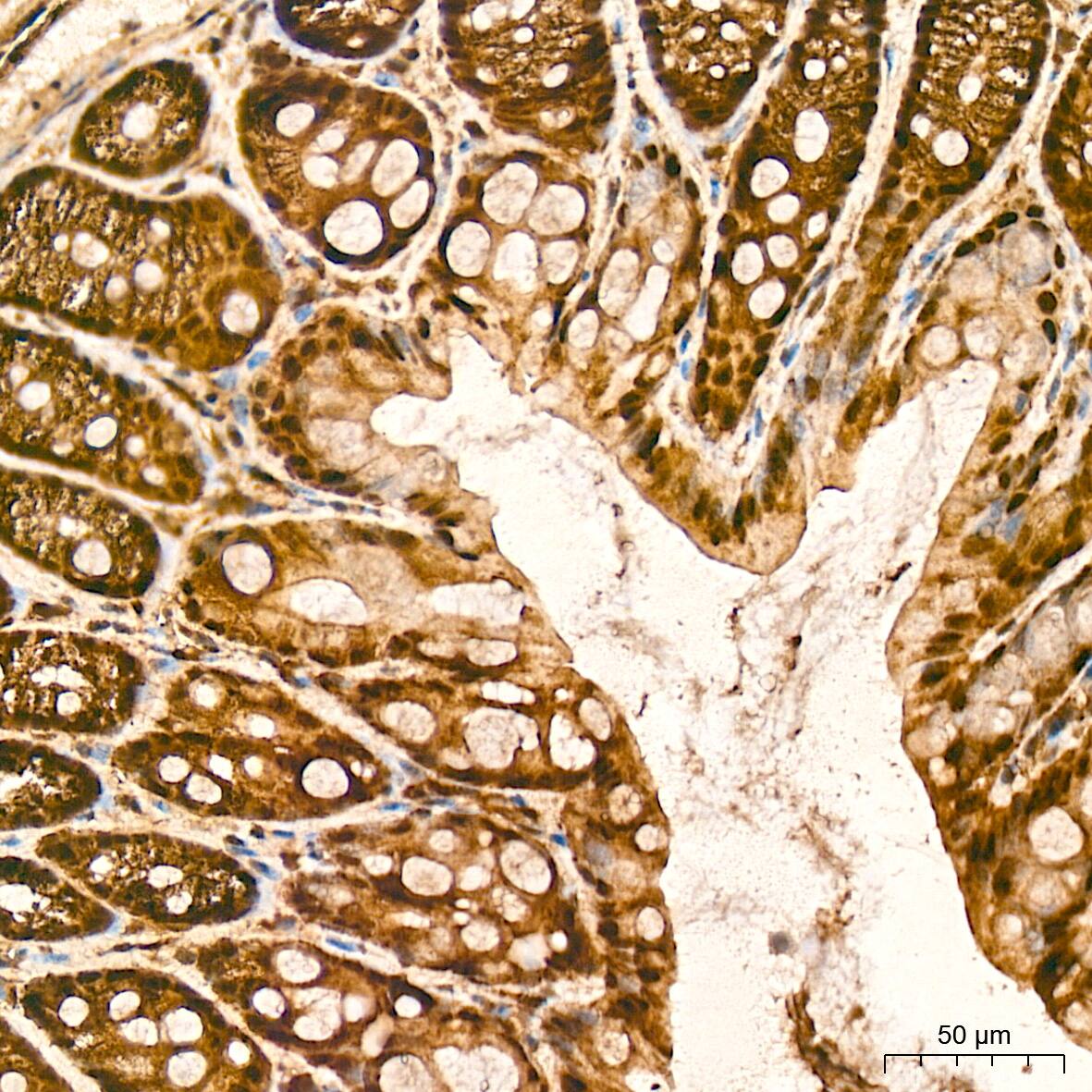 Protein Phosphatase 1 beta Antibody (5O9E7)