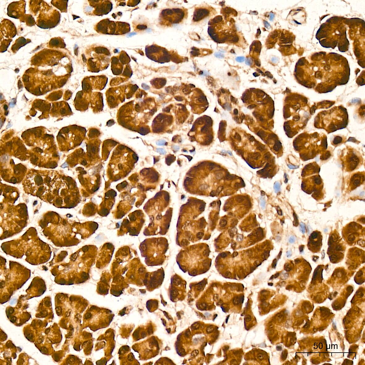 Protein Phosphatase 1 beta Antibody (5O9E7)