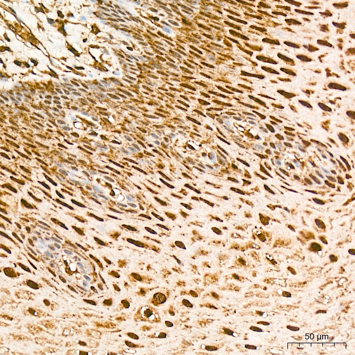 Protein Phosphatase 1 beta Antibody (5O9E7)
