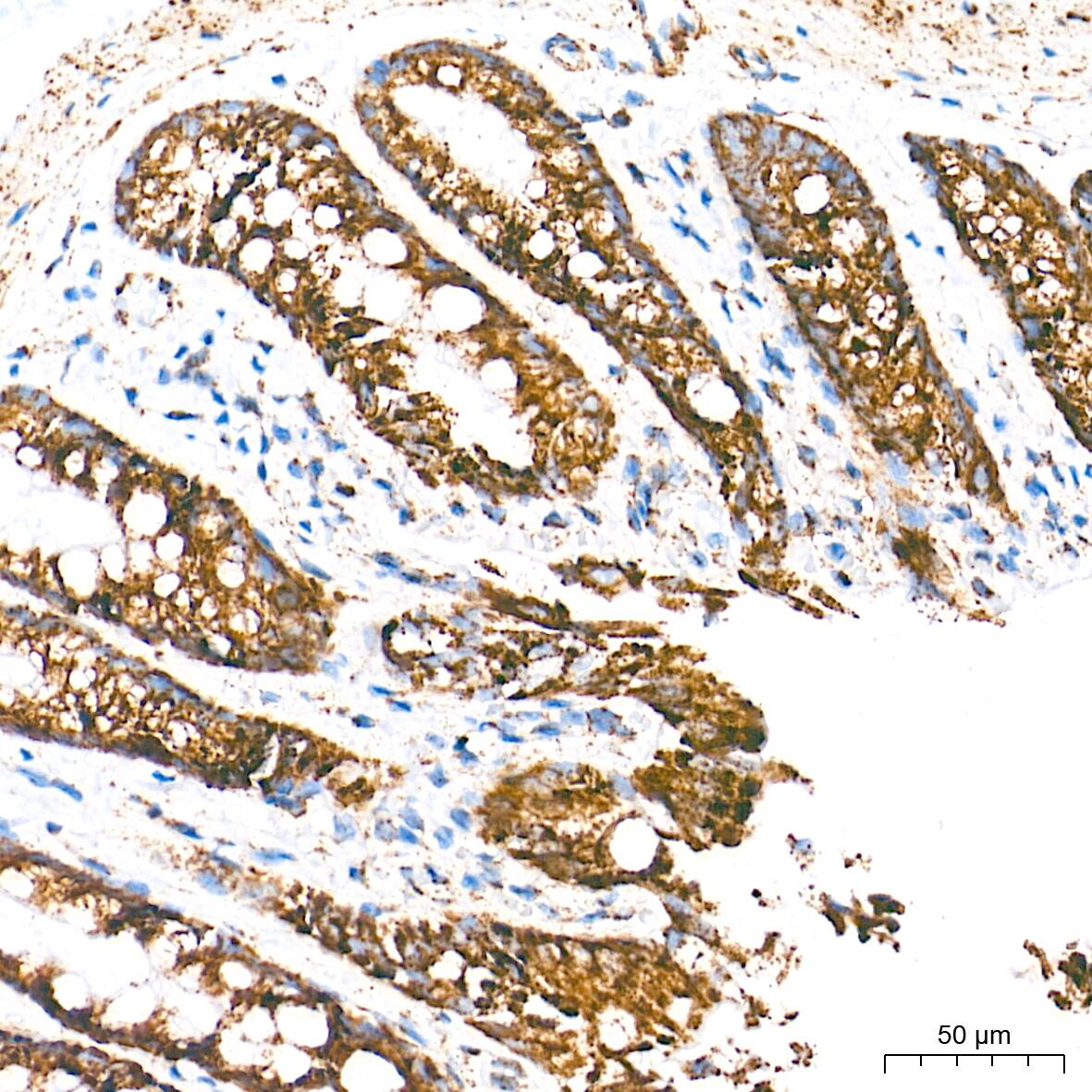 UQCRC2 Antibody (3E3O8)