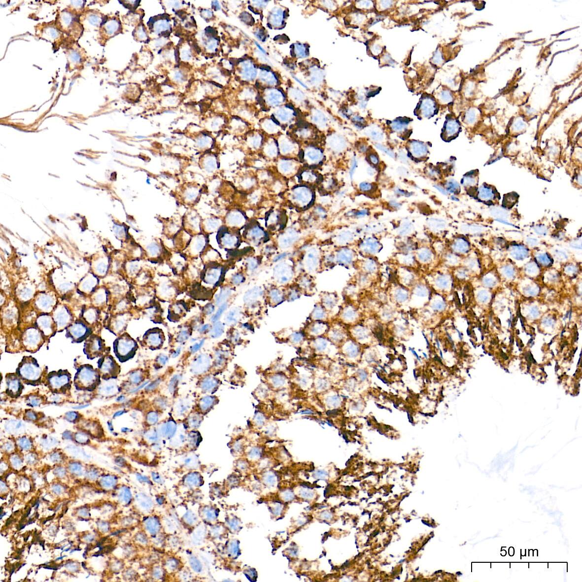 UQCRC2 Antibody (3E3O8)