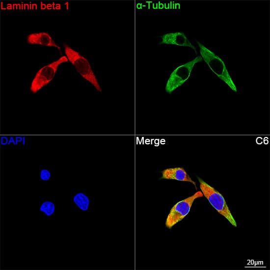 Laminin beta 1 Antibody (6I9T4)