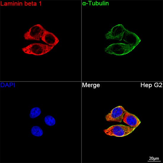 Laminin beta 1 Antibody (6I9T4)