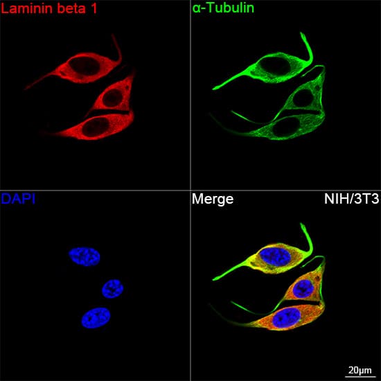 Laminin beta 1 Antibody (6I9T4)