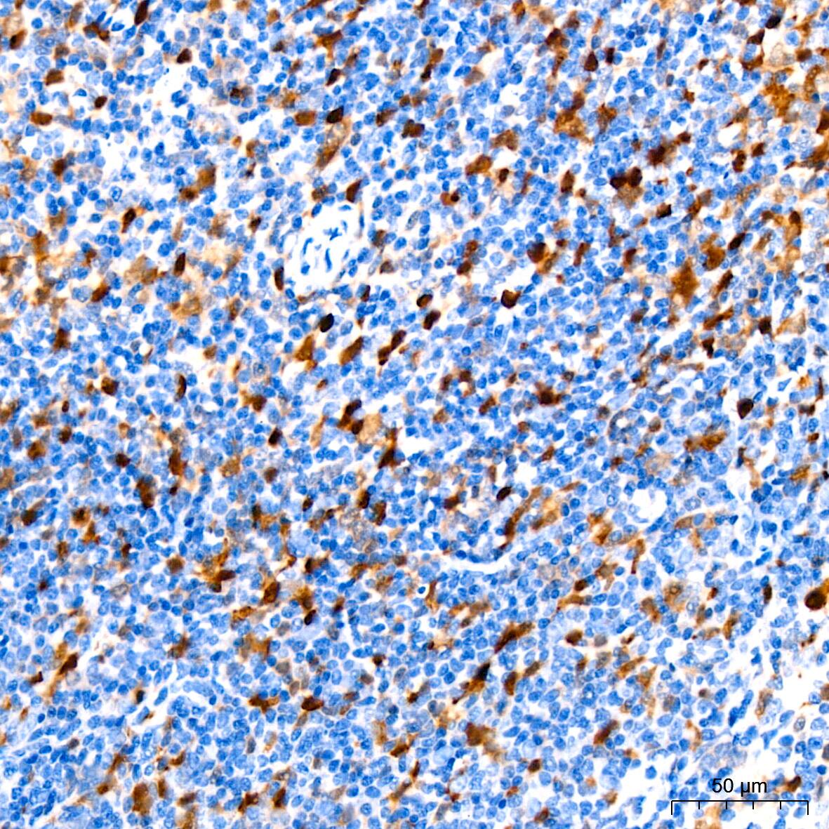 Stathmin 1 Antibody (7Y7H4)