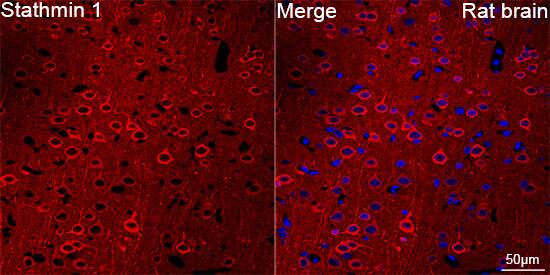 Stathmin 1 Antibody (7Y7H4)